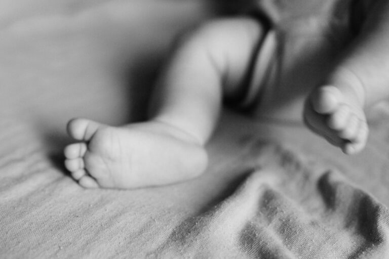 Synovial Sarcoma of the Parotid Gland in Infancy: A Rare Case Study