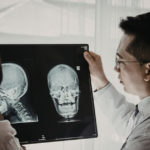 Two doctors examine X-ray images of a human skull, one in profile and one facing forward, while discussing the results in a well-lit medical setting.