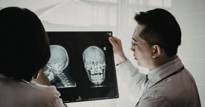 Two doctors examine X-ray images of a human skull, one in profile and one facing forward, while discussing the results in a well-lit medical setting.
